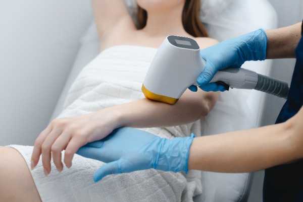 laser hair removal in Peterborough