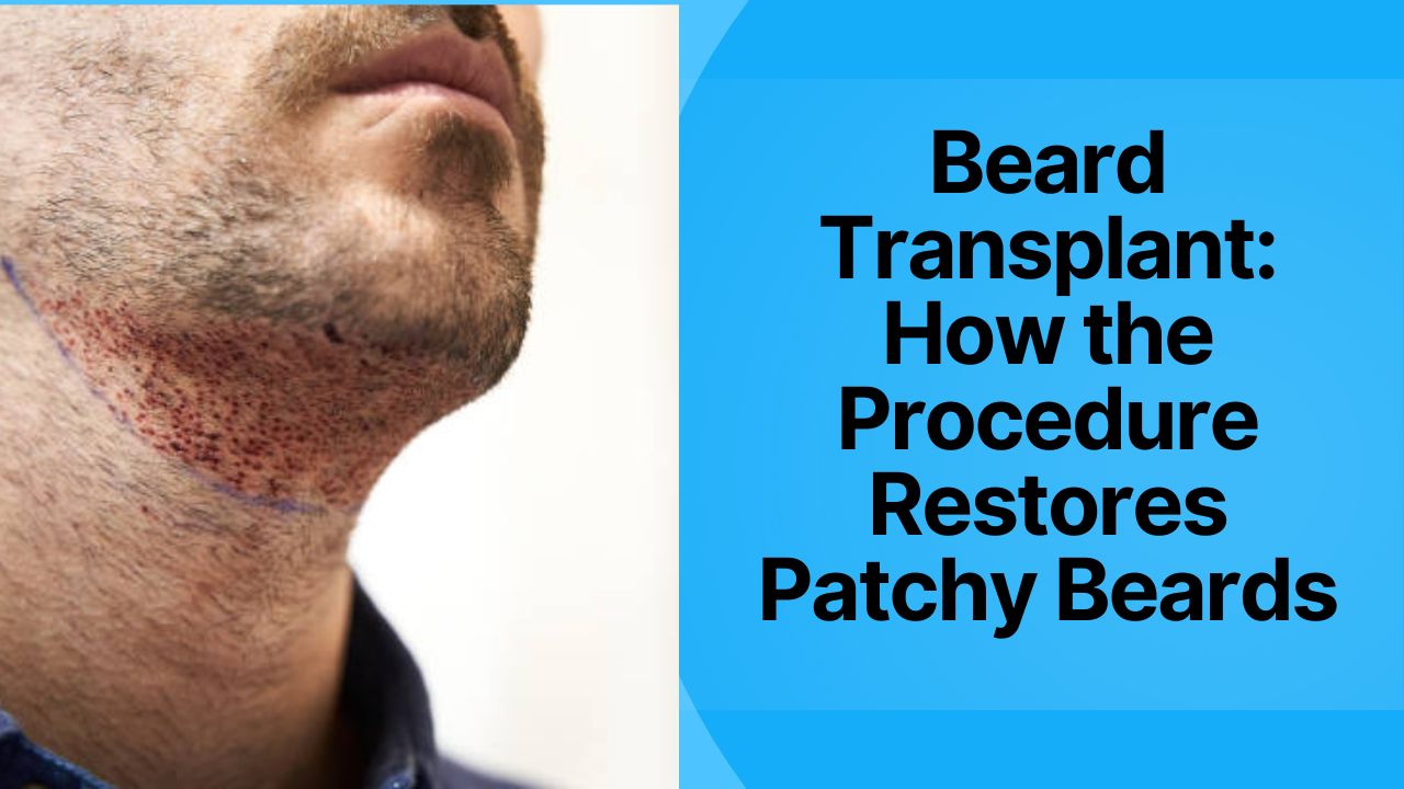 beard transplant