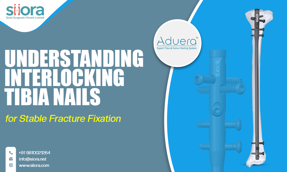 Understanding Interlocking Tibia Nails for Stable Fracture Fixation
