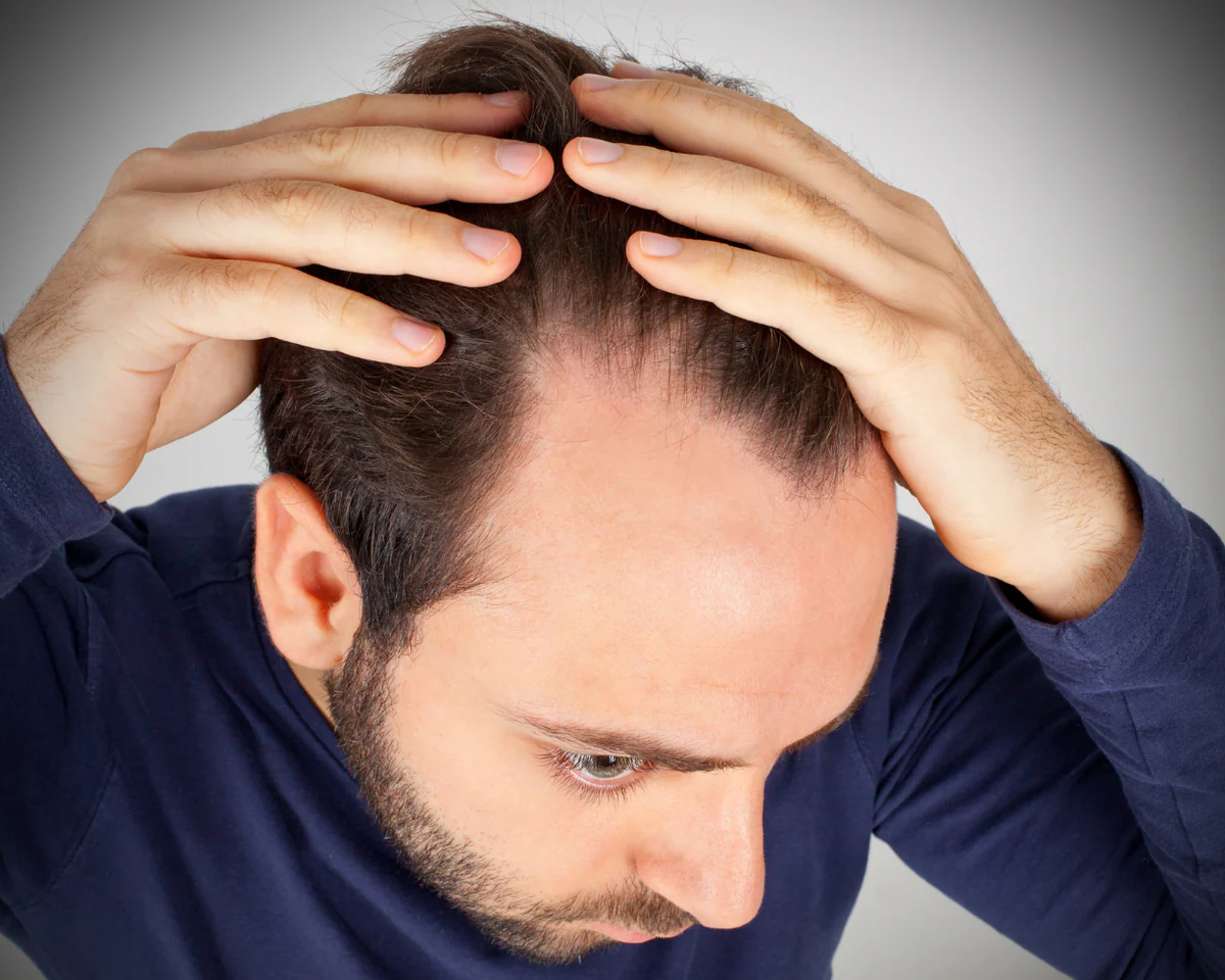 buy generic finasteride online