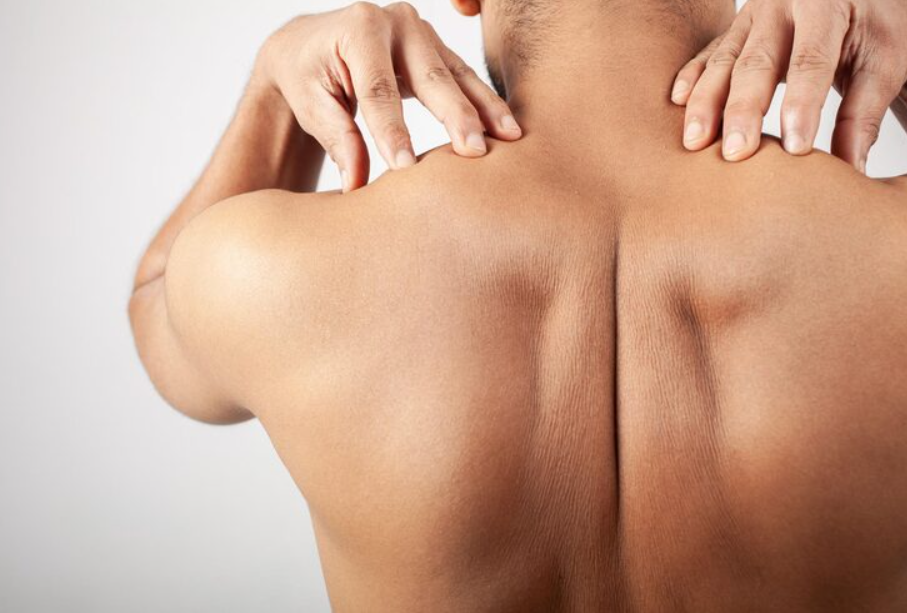 Botox for Trapezius Muscles Reduce Tension in Sacramento