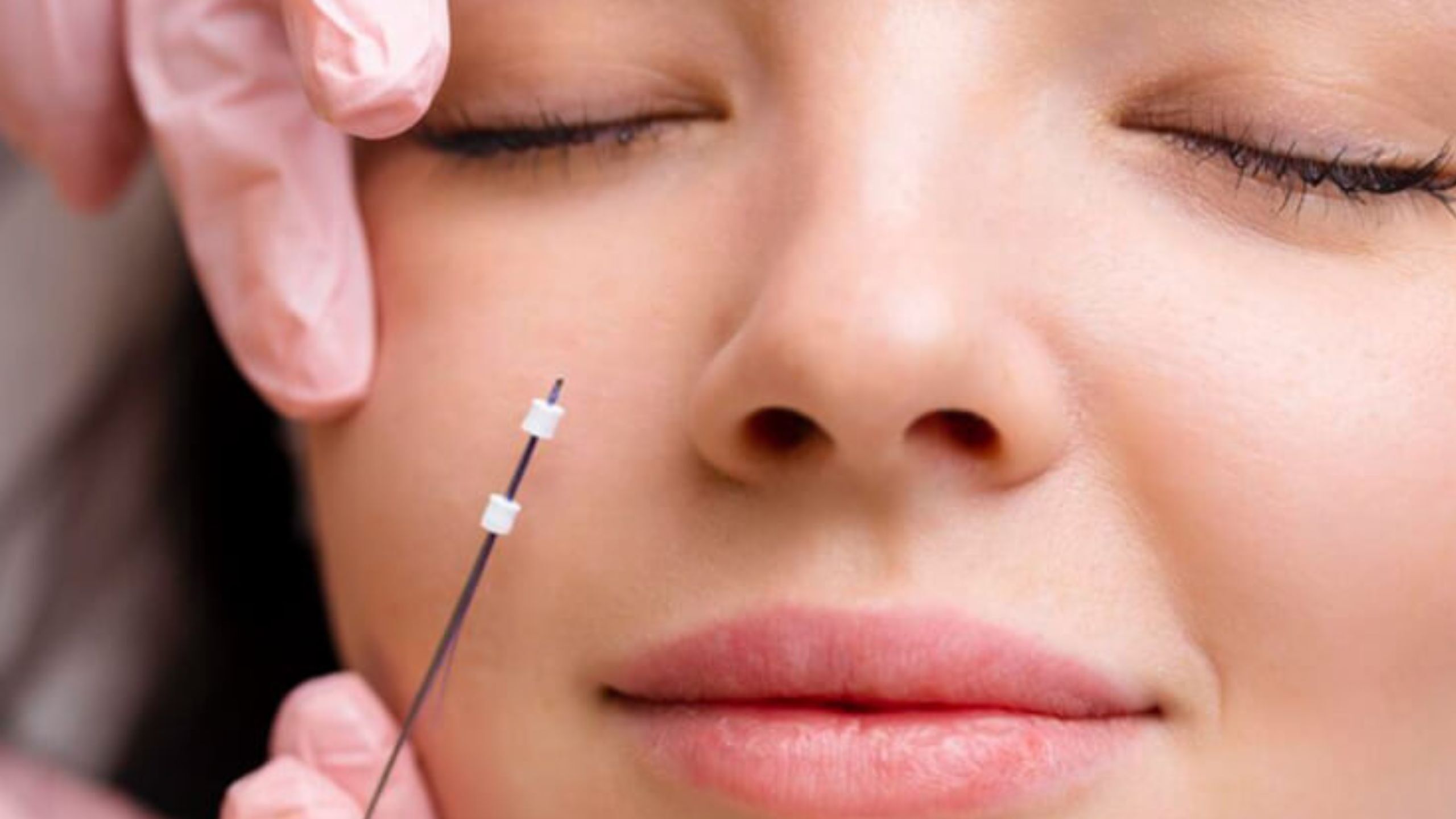 draadlift behandling (1)